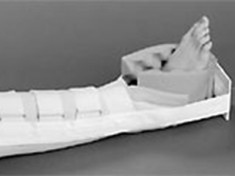 universal-bucks-traction-splint